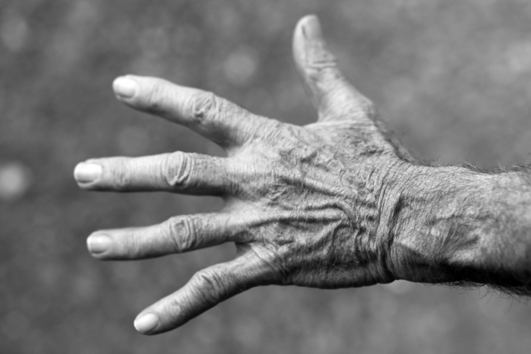 Nahaufnahme einer alten, faltigen Hand mit ausgestreckten Fingern in Schwarzweiß.